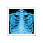 x-ray