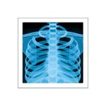 x-ray